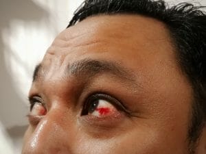 Habits that are destroying your eyes' health