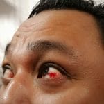 Habits that are destroying your eyes' health